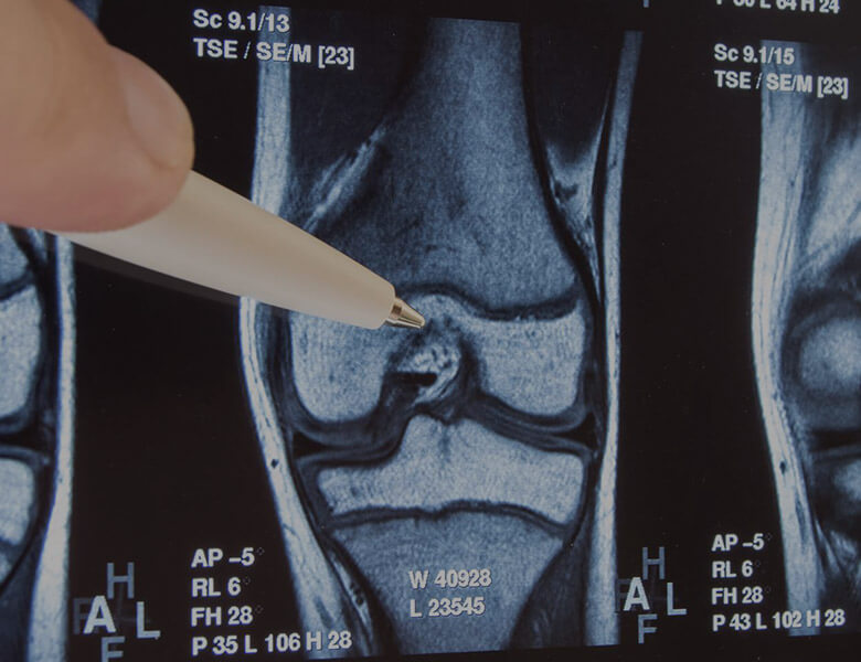 ss-grid-orthopedic2